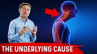 Scoliosis, Kyphosis, Lordosis and Vitamin D Explained by Dr.Berg