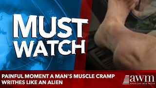 Painful moment a man's muscle cramp writhes like an alien