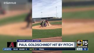 Paul Goldschmidt hit in head by pitch - ABC15 Sports