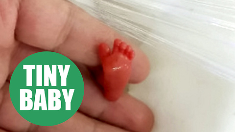 One of the world's smallest babies ever to survive who weighs the same as a bar of CHOCOLATE