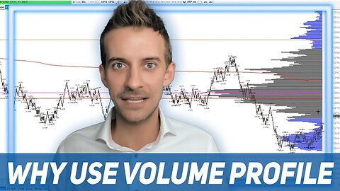 How You Can Trade With Volume Profile (And Keep Away From Technical Indicators) | Trading