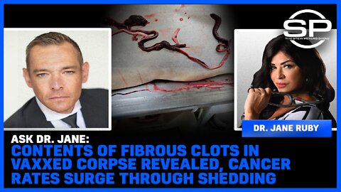 Contents Of Fibrous Clots In Vaxxed Corpse Revealed, Cancer Rates Surge Through Shedding