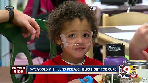 Alexandria 5-year-old inspires fundraiser for lung disease research