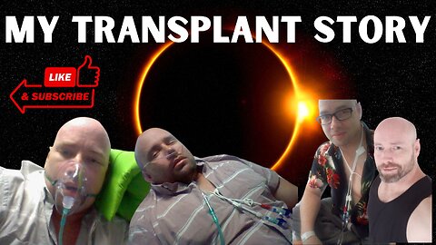 My stem-cell transplant story (short version) They didn't expect me to survive.