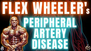 Pro Bodybuilder Flex Wheeler Develops Peripheral Artery Disease After Losing Kidney