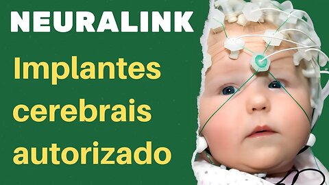 IMPLANTES CEREBRAIS DA NEURALINK AUTORIZADO EM HUMANOS!