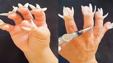 Asmr ingrown nail
