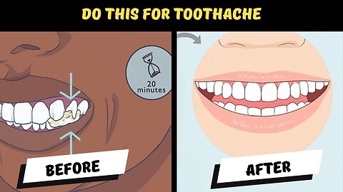 Instant home remedy of toothache