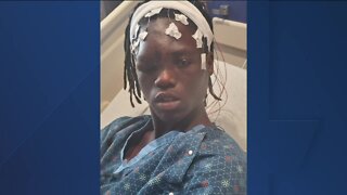 Mom speaks after son was shot with rubber bullet following unrest