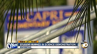 Student burned after science demonstration goes wrong