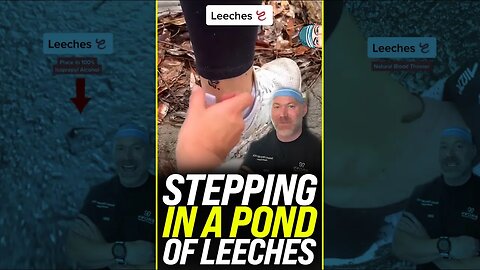 Stepping in Pond ￼of Leeches 😱 #shorts