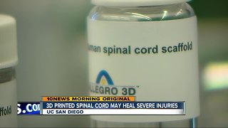 UC San Diego researchers use 3D Printing to heal spinal cord injuries