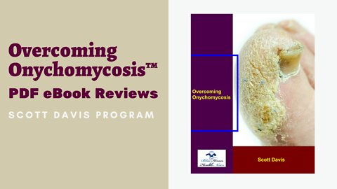 Overcoming Onychomycosis eBook PDF Reviews by Scott Davis