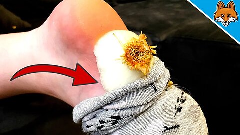 SOMETHING AMAZING happens, when you put an ONION in your SOCK 💥
