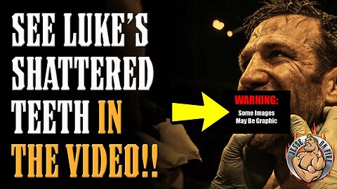Luke Rockhold's Teeth SHATTERED by Mike Perry!! SEE THE PICS! BKFC's BREAKOUT EVENT!!