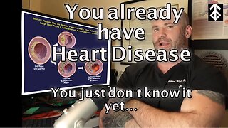 You have heart disease....you just don't know it.