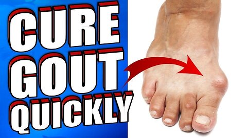 How to Get Relief from Gout Pain With Home Remedies