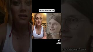 THIS IS TRAGIC!!! #viral #trending #facts #tiktok #news #medical #story #trans #viralvideo #reaction