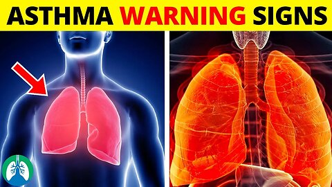 Top Early Warning Signs of Asthma *MUST KNOW* ⚠️
