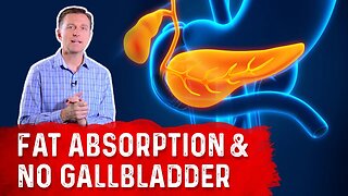 What Happens to Fat Absorption With NO Gallbladder? – Dr. Berg
