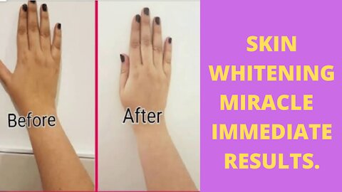 Skin Whitening Miracle Immediate Results Beauty tips