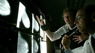 Study Says Many Women With Early Breast Cancer Might Not Need Chemo