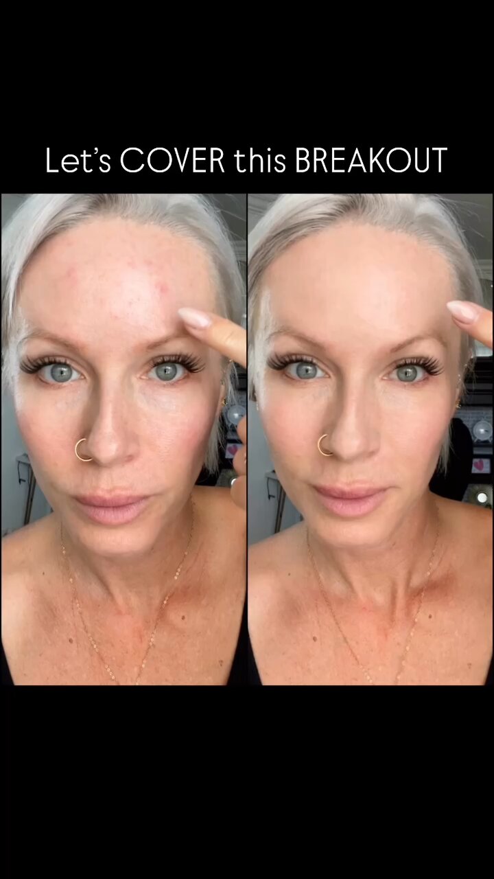 Let’s Cover These Breakouts(03)