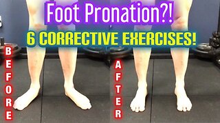 “Flat Feet/Duck Feet” *Foot OVERPRONATION* 6 BEST CORRECTIVE EXERCISES! | Dr Wil & Dr K