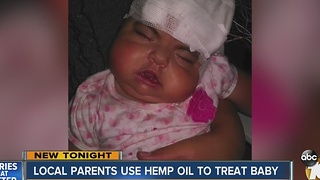 Local parents use hemp oil to treat baby