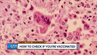 Not sure if you've been vaccinated for measles? Here's what to do
