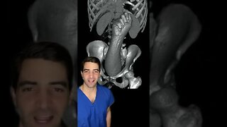 3D CT Scan