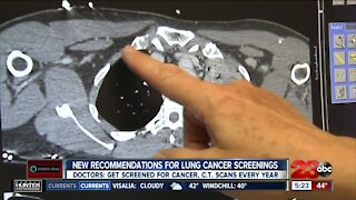 New recommendations for lung cancer screenings, get screened for cancer every year