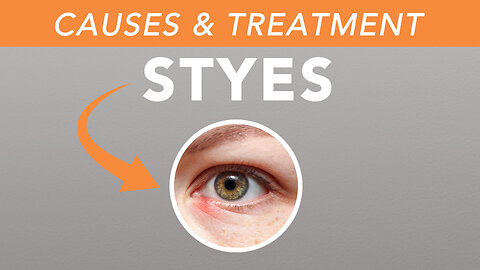 The Truth About Styes