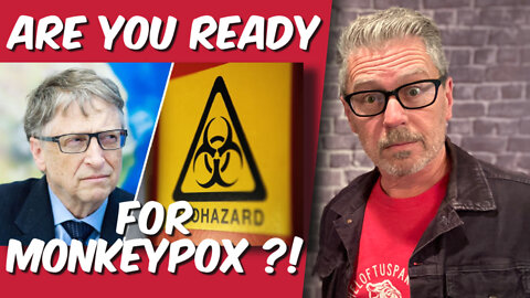 Are you ready for Monkeypox?