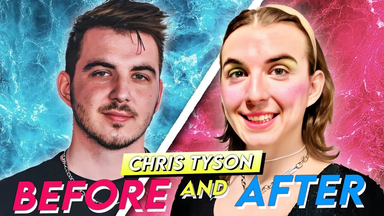 Chris Tyson Before & After MrBeast's CoStar HRT Transformation
