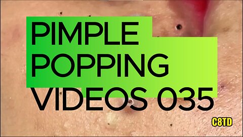 Satisfying Pimple Popping Videos 035