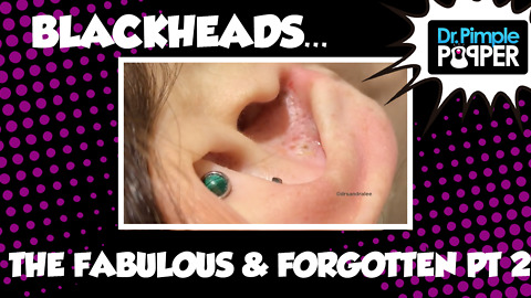 Blackheads: The Fabulous & Forgotten, Part Two