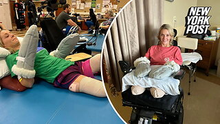 Mom Cindy Mullins at 'peace' with losing all 4 limbs after kidney stone operation: 'It's going to be OK