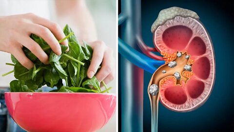 You've Been Eating Spinach Wrong... And This Could Harm Your Kidneys!