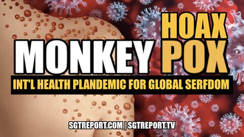 MONKEY HOAX: INTERNATIONAL HEALTH PLANDEMIC FOR GLOBAL SERFDOM