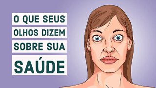 5 COISAS QUE SEUS OLHOS REVELAM SOBRE SUA SAÚDE