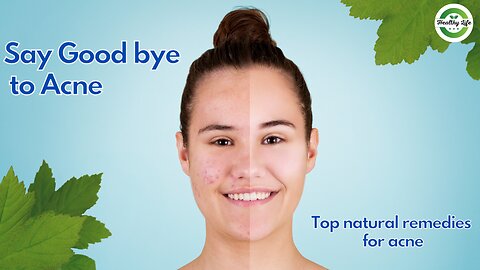 Clear Skin Secrets: Natural Remedies to Banish Acne Fast!