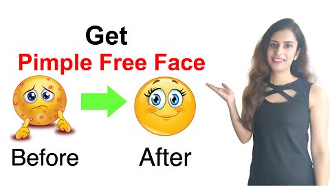 How to remove pimples naturally and permanently in one day | Acne Treatment