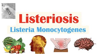 Listeriosis (Listeria Monocytogenes) | Sources, Pathophysiology, Symptoms, Diagnosis, Treatment