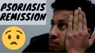 Psoriasis Remission