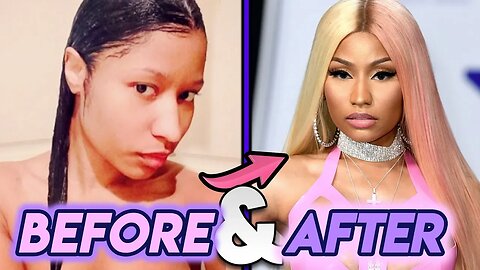 Nicki Minaj | Before and After Transformations | New Nose? Plastic Surgery Transformation