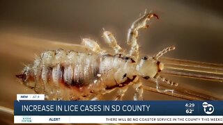 Lice cases increase in San Diego County