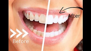 WHITEN YOUR TEETH WITH THESE 4 EASY STEPS!