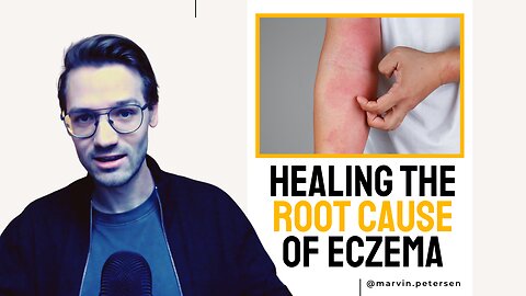 The Eczema-Gut Connection (Healing with the GAPS Diet)