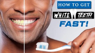 How to get WHITE TEETH at home FAST | 8 Quick Tips